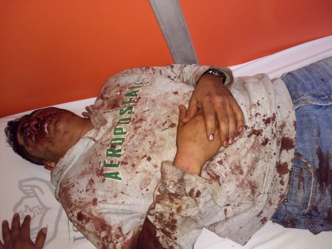 Policía Federal golpea a maestro en caseta de San Ángel; hubo disparos