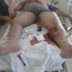 Motociclista atropellado