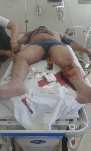 Motociclista atropellado