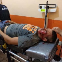 Motociclista cayó; herido