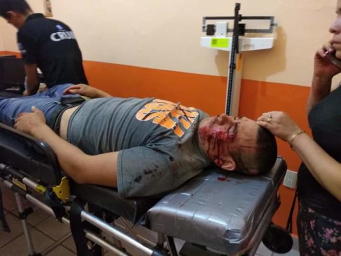 Motociclista cayó; herido