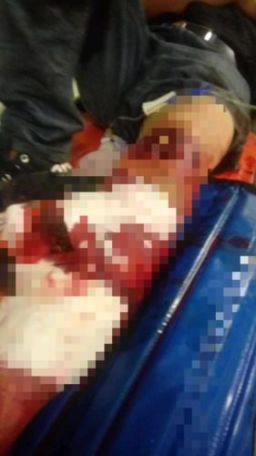 Lesionados al derrapar motocicleta