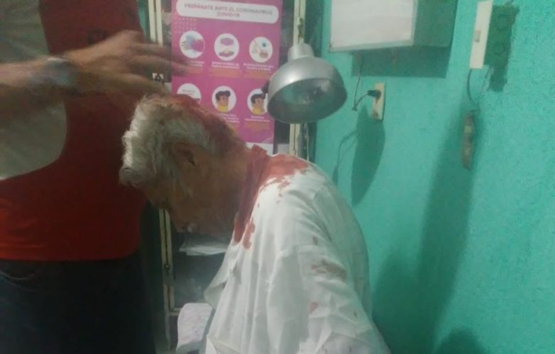 Autobús embiste a peatón; herido